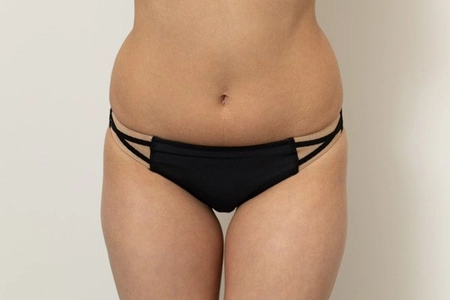 Bikini Briefs Prototype No. 36